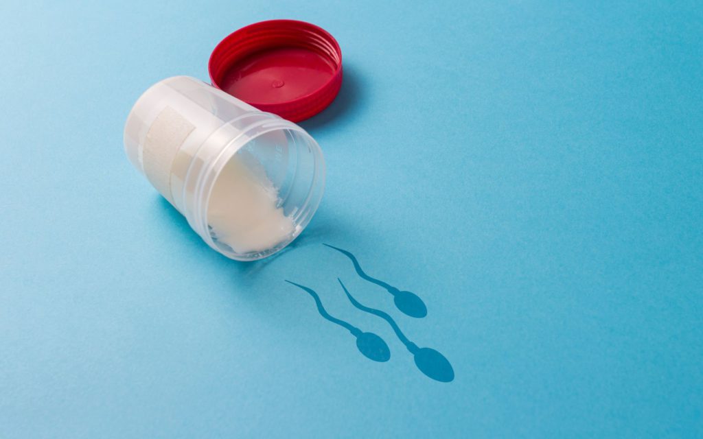 TESE sperm retrieval urology clinics manchester